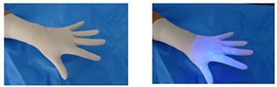 Contamination Associated With Glove Changing Techniques in the Operating Theatre